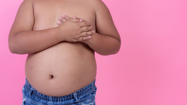 Tak Asal Gemuk, Ini Indikator Anak Alami Obesitas