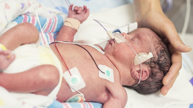 5 Kebutuhan Dasar Bayi Prematur (30418)