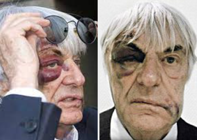 Bos F1, Bernie Ecclestone mengalami luka lebam setelah jadi korban perampokan. Foto: istimewa.