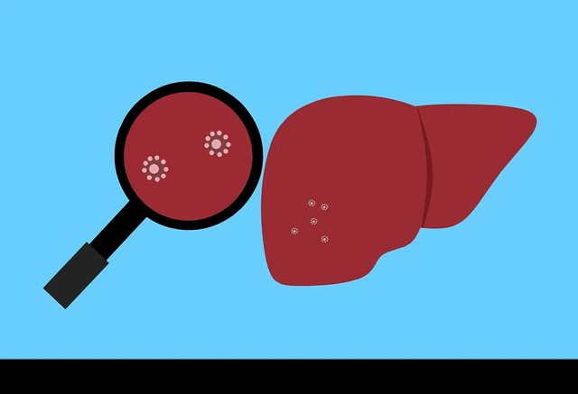 Pengertian Hepatitis Akut Beserta Gejala dan Cara Pengobatannya (290856)