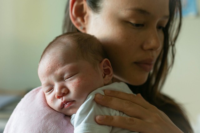 Cara Atasi Bruntusan pada Kulit Bayi (5460)