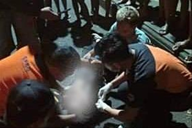 Kondisi MSR setelah nekat memukul kepalanya sendiri dengan batu sebanyak dua kali hingga tak sadarkan diri. Foto: Denita BR Matondang/kumparan
