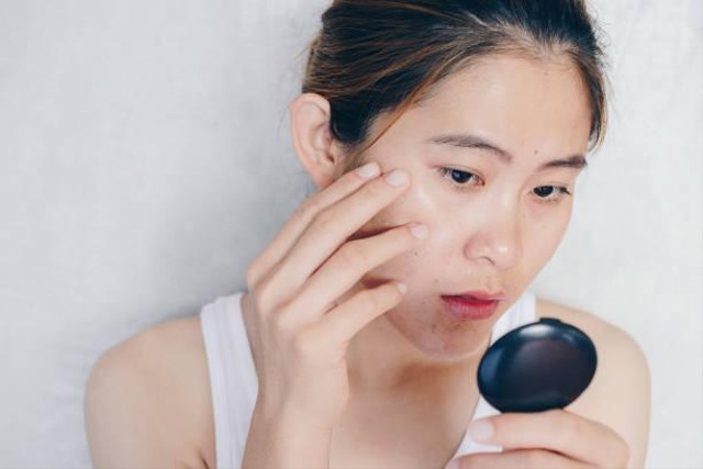 Eksfoliasi untuk Kulit Berminyak. Foto: iStockphoto