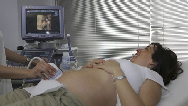 10 Istilah dalam USG Kehamilan yang Perlu Diketahui Ibu Hamil (17133)