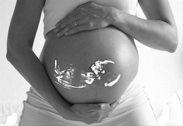 10 Istilah dalam USG Kehamilan yang Perlu Diketahui Ibu Hamil (17134)
