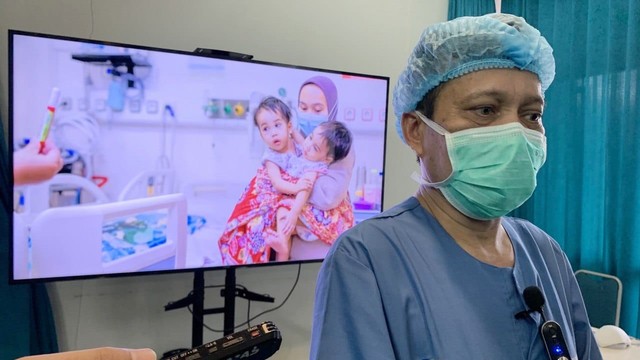 Bayi kembar siam asal Sukabumi berhasil dipisahkan usai menjalani operasi di RSHS Bandung.  Foto: Dok. Istimewa