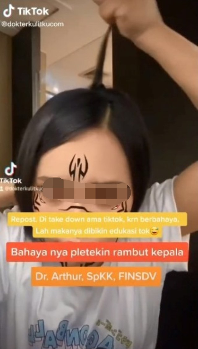 Viral menarik atau menjambak rambut bagi kaum perempuan. (Foto: TikTok/@dokterkulitkucom)