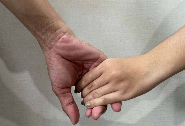 Pengakuan Korban Penganiayaan dalam Dugaan Perselingkuhan Anggota DPRD Surabaya