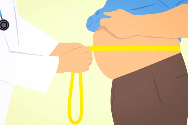 Ilustrasi obesitas pada anak. Foto: Pixabay/mohamed_hassan