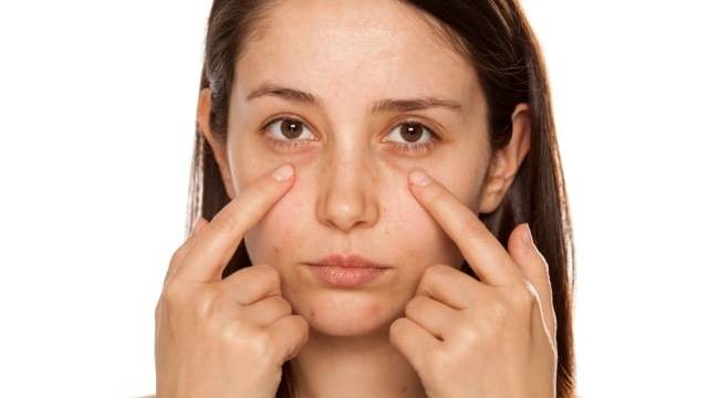 Ilustrasi mata bengkak. Foto: Shutterstock