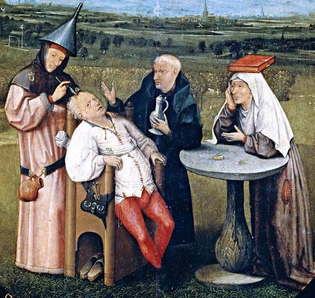Praktik trepanation atau melubangi kepala pada abad pertengahan di Eropa. Foto: Netherlands Institute for Art History