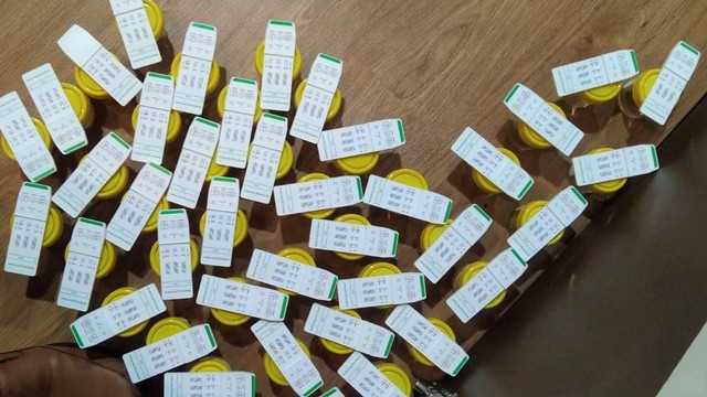 Hasil tes urine puluhan pejabat eselon II Pemprov Sumatera Barat yang dinyatakan negatif narkoba. Foto: dok Humas