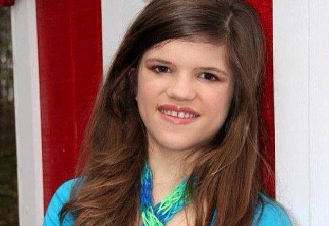 Ashlyn Blokcer, penderita CIPA yang tidak merasakan rasa sakit apapun. (Foto:: Facebook/@Azhar Malik).