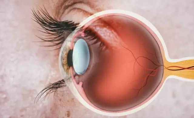 Ilustrasi bola mata yang di dalamnya terdapat otot polos untuk mengatur besar kecilya pupil. Foto: Unsplash