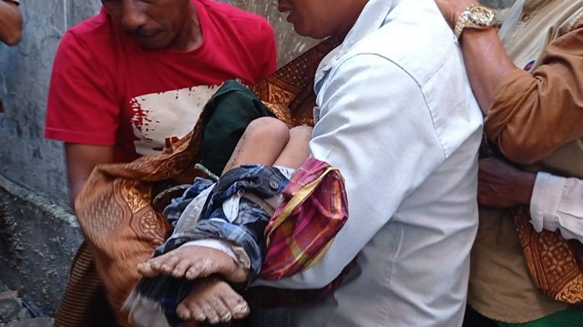 Bocah 6 Tahun di Sampang Diduga Dibunuh, Polisi: Korban Dibungkam dan Diikat