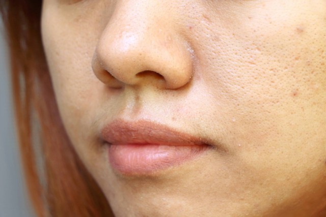 Ilustrasi pori-pori pada kulit perempuan. Foto: WHANJEED/Shutterstock