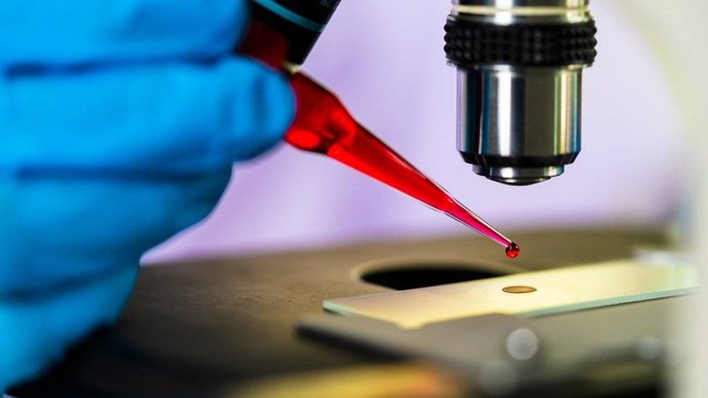 Pasien Keempat di Dunia yang 'Sembuh' dari HIV: Saya Tidak Berpikir Bisa Hidup (7495)