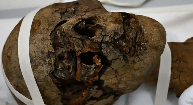 Kepala mumi mesir yang ditemukan di Inggris dan diduga dijadikan suvenir.  Foto: Maidstone and Tunbridge Wells NHS Trust