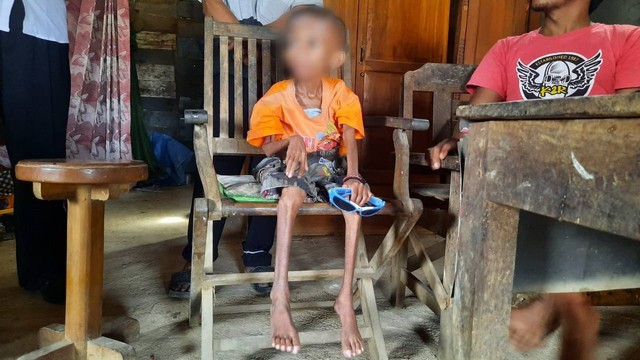 Rhyo Satria Dwi Putra (9), warga Desa Sumberejo, Kecamatan Japah, Kabupaten Blora, Jawa Tengah, yang alami gagal tumbuh sejak usia 3 tahun. (foto: dok istimewa)