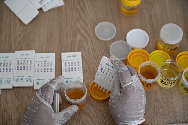 Petugas kesehatan memeriksa sampel urine untuk tes narkoba mahasiswa baru Universitas Syiah Kuala Banda Aceh pada 3 Agustus 2022. Foto: Chaideer Mahyuddin/AFP