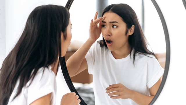 Kulit Tidak Sehat Bikin Rasa Percaya Diri Bisa Menurun? Ini Kata Psikolog. Foto: Kateryna Onyshchuk/Shutterstock