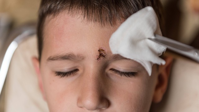 Ilustrasi cara membersihkan luka anak. Foto: Ivana P. Nikolic/Shutterstock