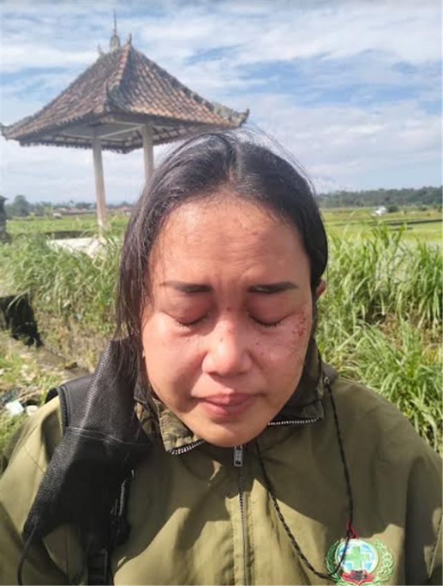 Perempuan di Bali Tertembak Airsoft Gun dari Mobil Pelat B/Dok. Polres Badung