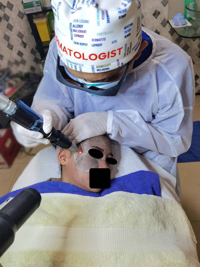 Hilangkan Tanda Lahir dan Tato Secara Aman dengan Laser di Surabaya Skin Centre (339339)