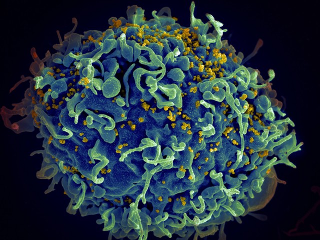 Virus HIV adalah virus yang bisa menyerang sistem kekebalan tubuh dan menyebabkan penyakit AIDS. Foto: Unsplash.com