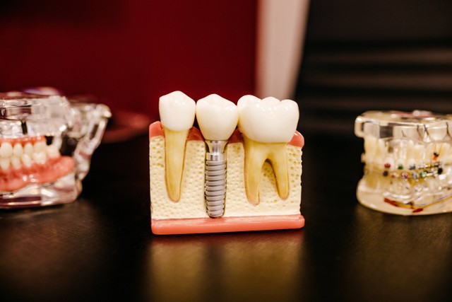 Bagaimana cara memutihkan gigi kuning yang membandel? Foto: Unsplash
