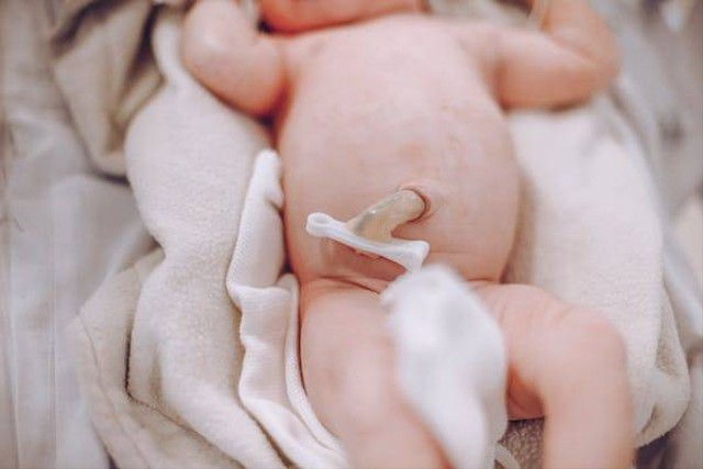 Ilustrasi cara merawat tali pusar bayi (Sumber: Pexels)