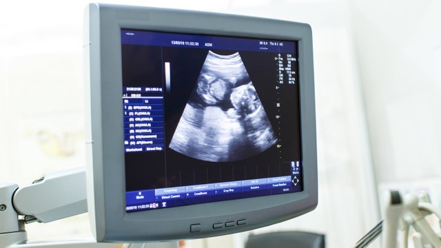 Ilustrasi USG kepala pada bayi prematur. Foto: ANUCHIT MANMAI/Shutterstock