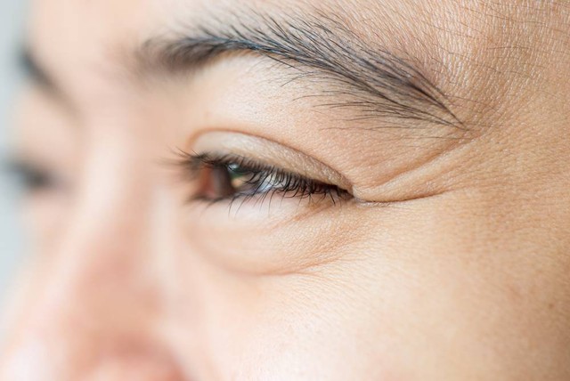 Ilustrasi kulit wajah yang berkerut. Foto: life-literacy/Shutterstock