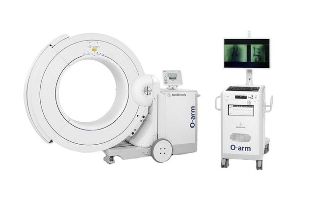 Teknologi O-arm dalam operasi skoliosis Eka Hospital. Foto: Eka Hospital