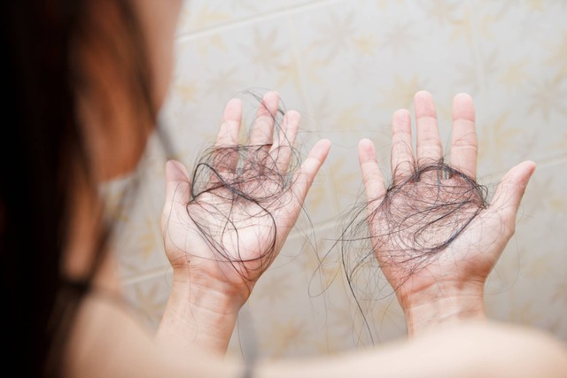 Ilustrasi rambut rontok. Foto: Shutterstock