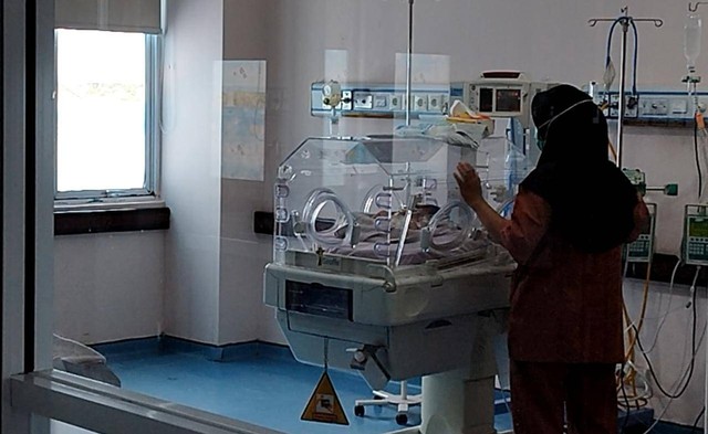 Bayi kembar siam dalam penanganan RSUP M Djamil Kota Padang, Rabu (22/9/2022). Foto: Istimewa