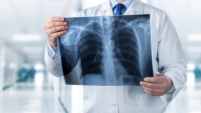 Ilustrasi dokter radiologi. Foto: Billion Photos/Shutterstock