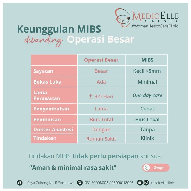 Mengenal MIBS, Angkat Benjolan Jinak Payudara Tanpa Bius Total (1)