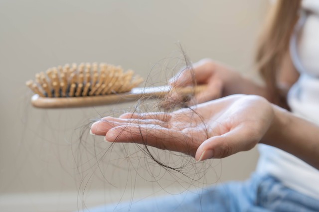 Ilustrasi rambut rontok. Foto: Kmpzzz/Shutterstock