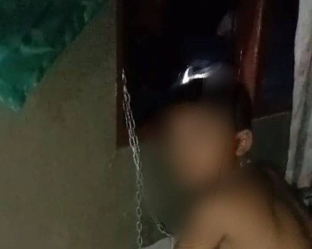 2 Anak yang Dirantai Ibunya di Bali Ditempatkan di Rumah Aman