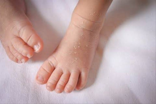 Ilustrasi kaki bayi. | Foto: Shutterstock