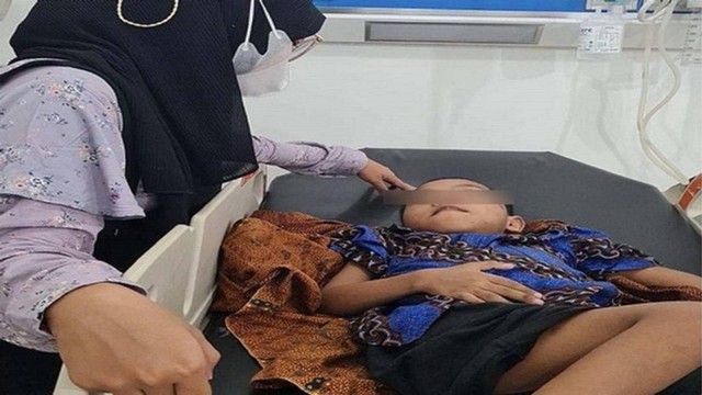 Bocah disabilitas menjadi korban penganiayaan ayah tiri di Pekanbaru, Riau. (Dok. Istimewa)