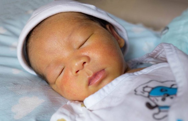 Ilustrasi penyakit kuning pada bayi. Foto: Bonn_A/Shutterstock