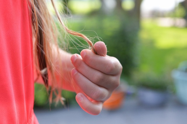Rambut rontok parah adalah gangguan kesehatan ketika rambut berjatuhan secara berlebihan. Foto: Pexels.com