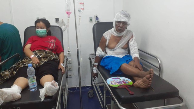 Dua orang korban terbakar tabung LPG bocor di Cianjur, Selasa (1/11). Foto: Dok. Istimewa