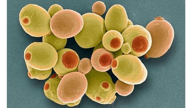 Ragi bir Saccharomyces cerevisiae dapat ditemukan di antara mikroba yang hidup di usus kita.