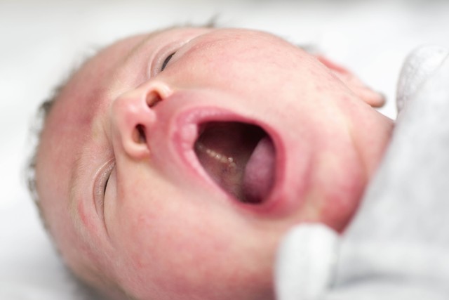 5 Obat Rumahan untuk Sariawan pada Bayi. Foto: Jaroslav Moravcik/Shutterstock