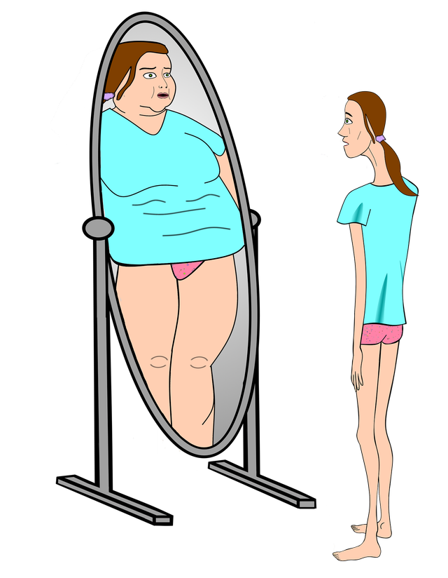 Ilustrasi penderita eating disorder (Sumber: https://pixabay.com/illustrations/bulimia-anorexia-nervosa-4049661/)