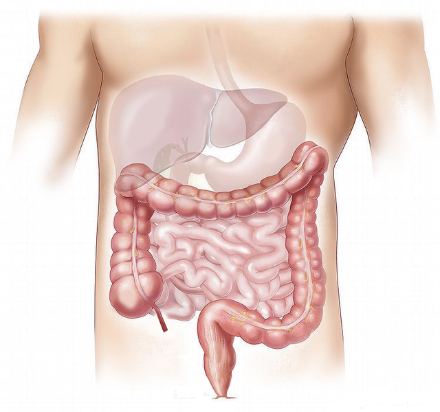 Ilustrasi usus besar. Foto: Pixabay.com