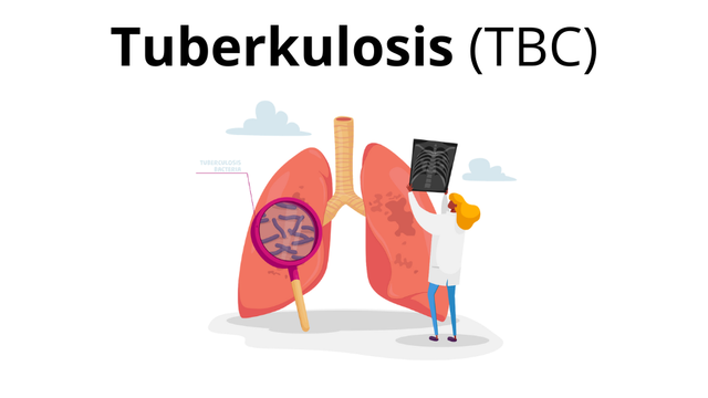 Ilustrasi pemeriksaan rontgen sakit TBC